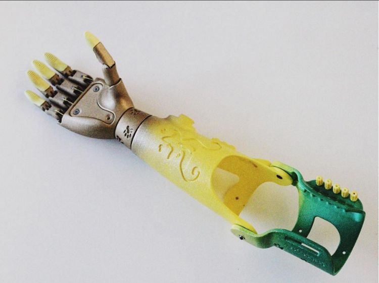 3D printed Motorika prosthesis will be absolutely free