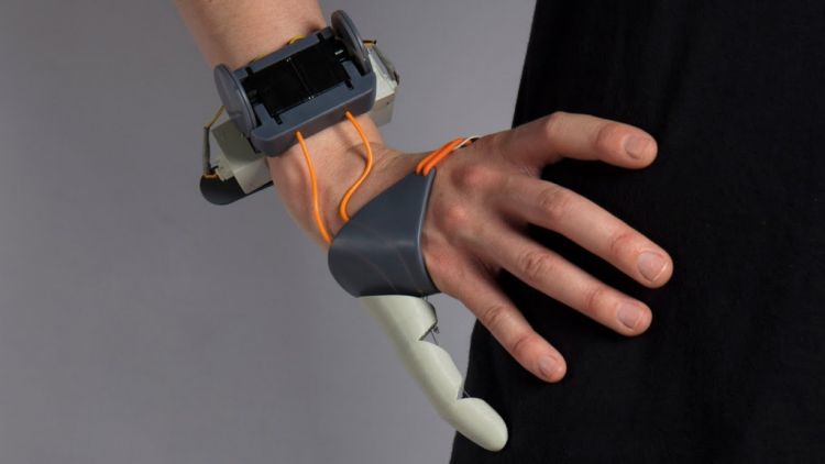 A woman living in Britain created a 3D printed thumb