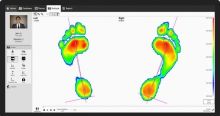 Joint venture RSPrint to offer customized dynamic 3D printed insoles