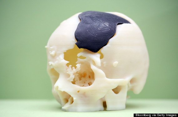 3D Bones