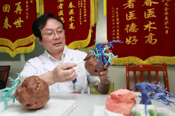 3D printing technology successfully used to guide a complex liver resection in China